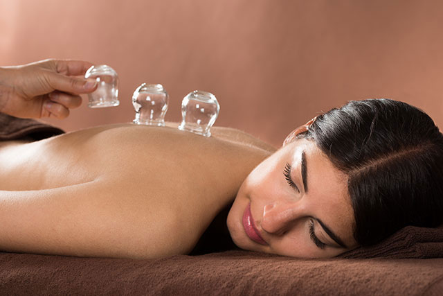 What is cupping therapy?